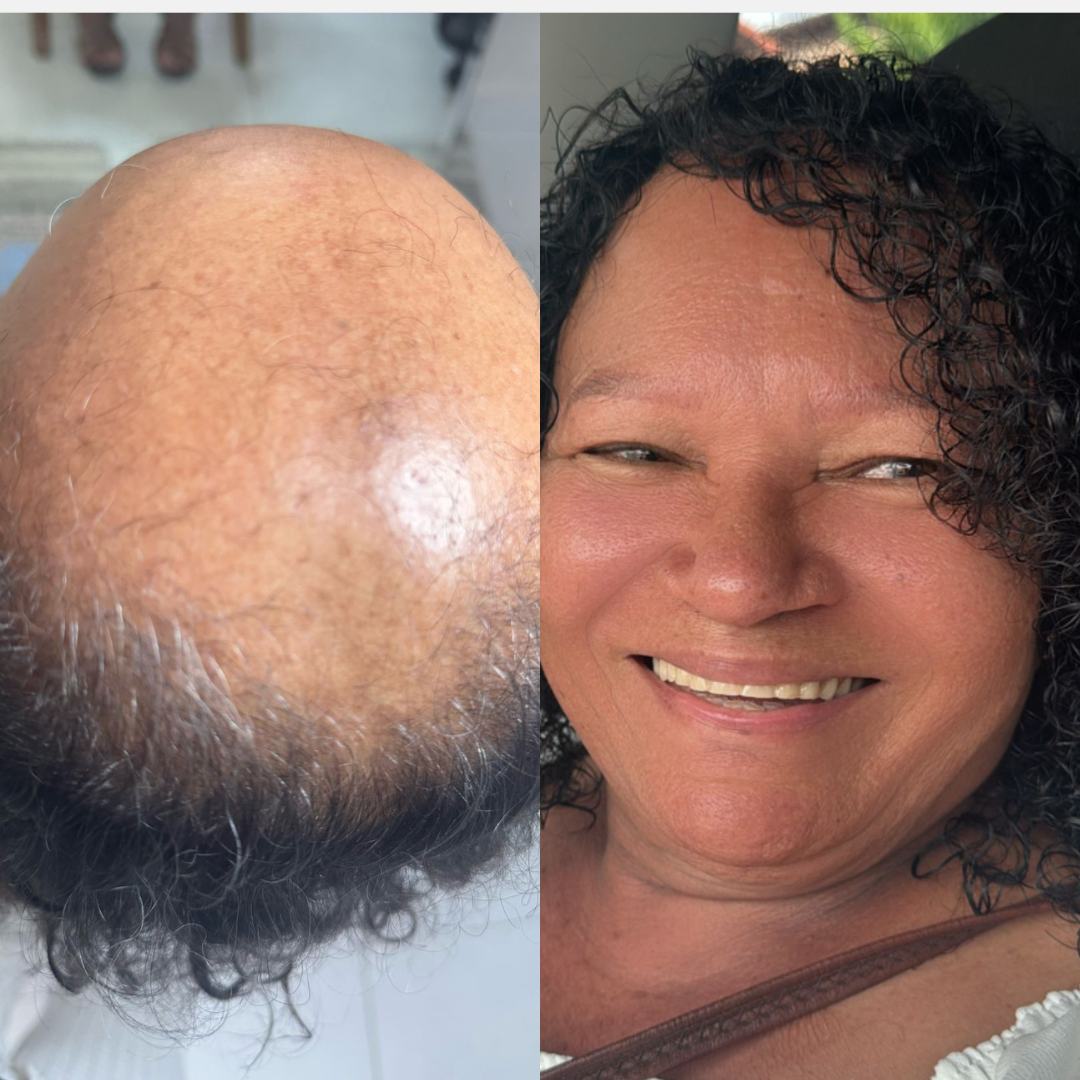 Post Instagram Beleza Estética Facial Peeling Minimalista